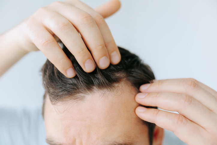 Encapsulated adenosine for hair density and scalp care